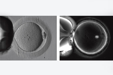 Spindle-Imaging